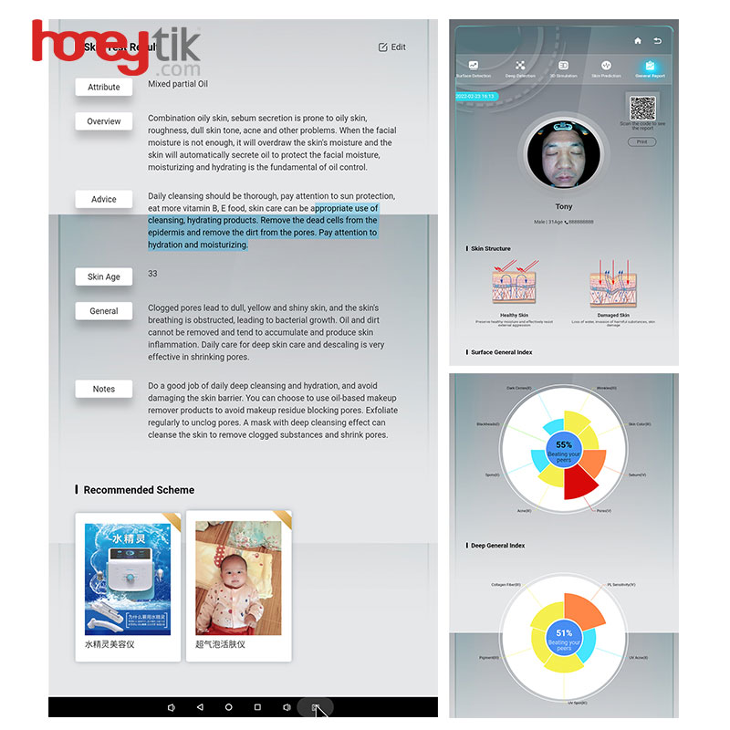 Facial Skin Analyzer Magic Mirror 3d Ai Wrinkle Test